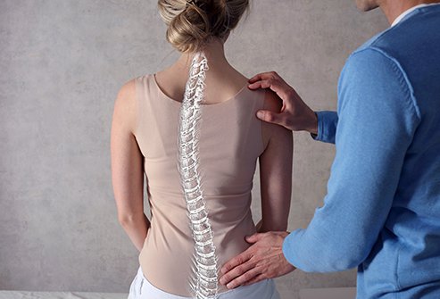 Spinal Deformity Treatment in Pimpri Chinchwad