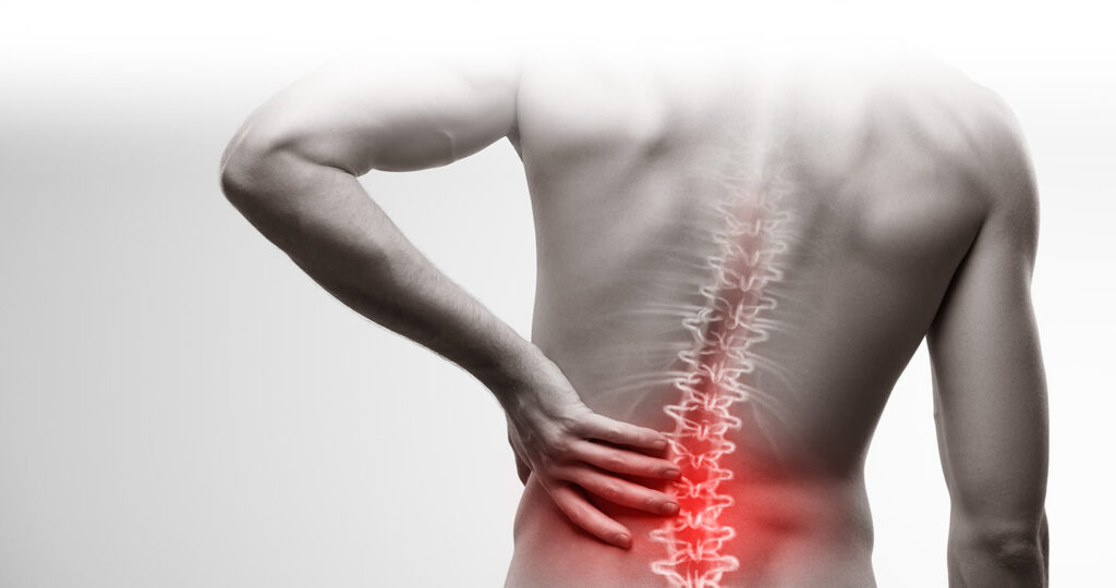 Acute Back Pain
